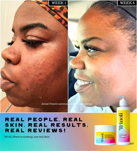 CLEAR COMPLEXION COLLECTION