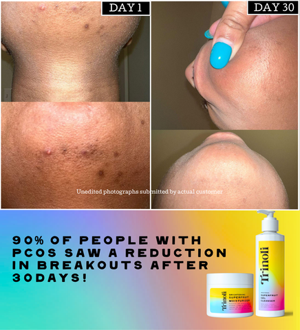 CLEAR COMPLEXION COLLECTION