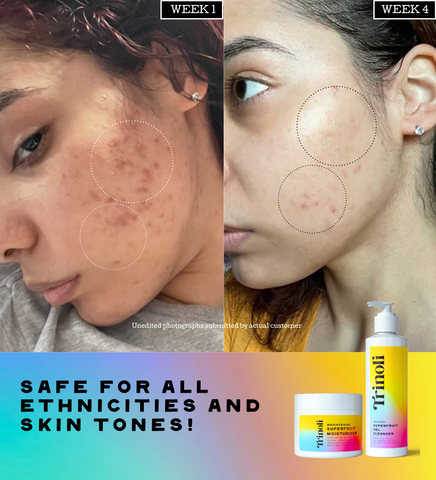 CLEAR COMPLEXION COLLECTION