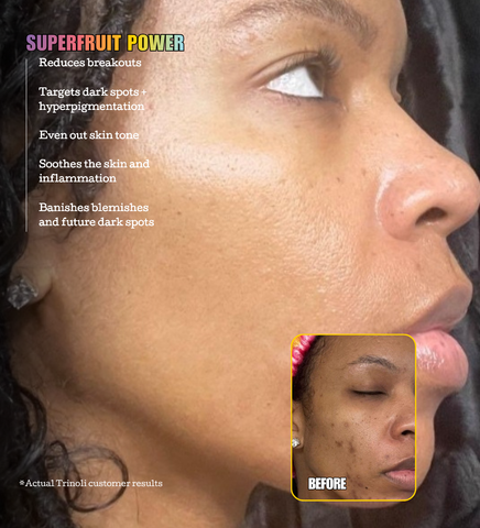 CLEAR COMPLEXION COLLECTION