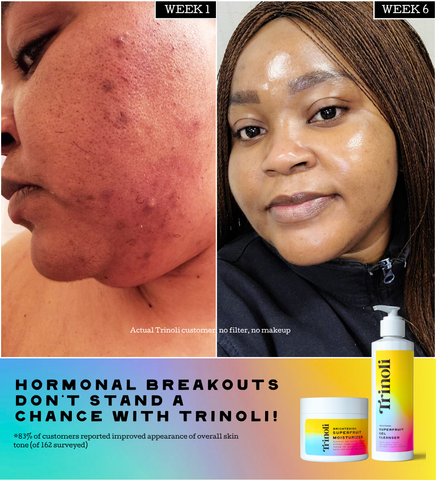 CLEAR COMPLEXION COLLECTION